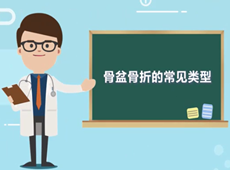 【醫療科普】骨盆骨折的常見類型有哪幾種？