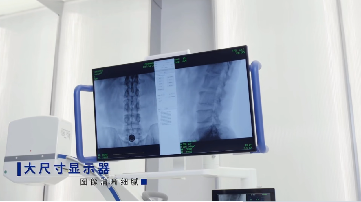 一體式移動(dòng)C形臂大尺寸顯示器